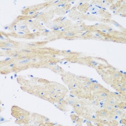 Putative N-Acetyltransferase 8B (NAT8B) Antibody