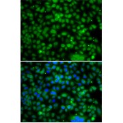 Immunofluorescence analysis of A-549 cells using PHYHD1 Antibody
