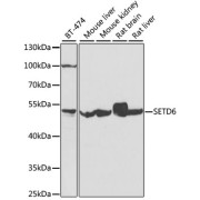 Western blot analysis of extracts of various cell lines using SETD6 Antibody (1/1000 dilution).