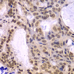 DNA Polymerase Delta 3, Accessory Subunit (POLD3) Antibody