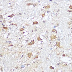 Mu-Type Opioid Receptor (OPRM1) Antibody