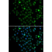 Immunofluorescence analysis of MCF-7 cells using LMO4 Antibody Blue: DAPI for nuclear staining.