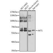 abx005477