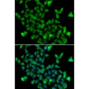 Immunofluorescence analysis of MCF-7 cells using ASPA Antibody