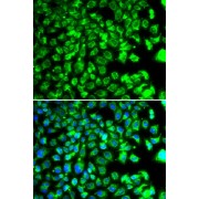 Immunofluorescence analysis of MCF-7 cells using C10orf32 Antibody