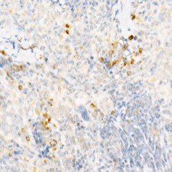 C-C Motif Chemokine 2 / MCP1 (CCL2) Antibody