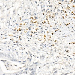 C-C Motif Chemokine 2 / MCP1 (CCL2) Antibody