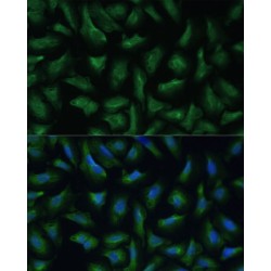 Leukocyte Surface Antigen CD47 (CD47) Antibody