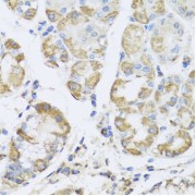 Immunohistochemistry of paraffin-embedded Human stomach using PRKAG1 Antibody (1/100 dilution, 40x lens).