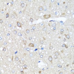 5'-AMP-Activated Protein Kinase Subunit Gamma-1 (PRKAG1) Antibody