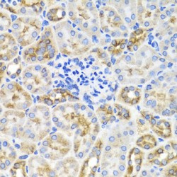 5'-AMP-Activated Protein Kinase Subunit Gamma-1 (PRKAG1) Antibody