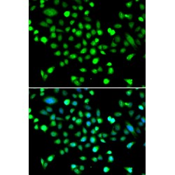 5'-AMP-Activated Protein Kinase Subunit Gamma-1 (PRKAG1) Antibody