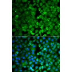 Runt Related Transcription Factor 3 (RUNX3) Antibody