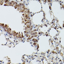 Transcription Factor EB (TFEB) Antibody