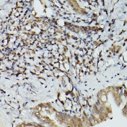 Transcription Factor EB (TFEB) Antibody