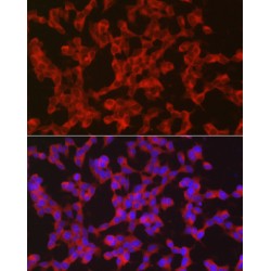Retinol (RET) Antibody