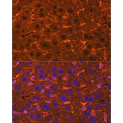 Ceruloplasmin (CP) Antibody