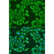 Immunofluorescence analysis of U2OS cells using CYP11B1 Antibody (1/100 dilution). Blue: DAPI for nuclear staining.