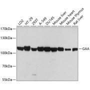 Western blot analysis of extracts of various cell lines using GAA Antibody (1/1000 dilution).