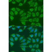 Immunofluorescence analysis of U2OS cells using ADH7 Antibody (1/100 dilution). Blue: DAPI for nuclear staining.