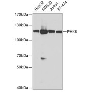 Western blot analysis of extracts of various cell lines using PHKB Antibody (1/1000 dilution).