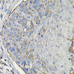 Tumor-Associated Calcium Signal Transducer 2 (TACSTD2) Antibody
