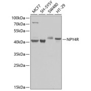 abx005705