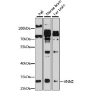 Western blot analysis of extracts of various cell lines using VNN2 Antibody (1/1000 dilution).