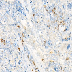 Interleukin 27 Receptor Alpha (IL27RA) Antibody