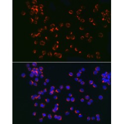 Toll-Like Receptor 6 (TLR6) Antibody