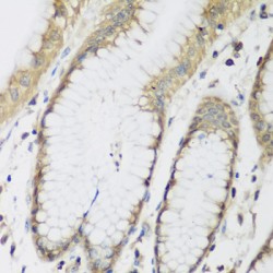 Methyltransferase-Like Protein 7A (METTL7A) Antibody
