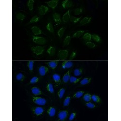 ATPase Family AAA Domain-Containing Protein 3A (ATAD3A) Antibody