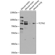 Western blot analysis of extracts of various cell lines using TCTN2 Antibody (1/1000 dilution).