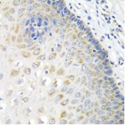 Immunohistochemistry of paraffin-embedded Human esophagus using STXBP4 Antibody (1/100 dilution, 40x lens).