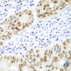 Mediator Of DNA Damage Checkpoint 1 (MDC1) Antibody