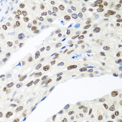 Mediator Of DNA Damage Checkpoint 1 (MDC1) Antibody