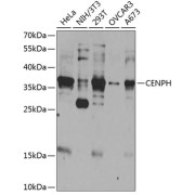 Western blot analysis of extracts of various cell lines using CENPH Antibody (1/1000 dilution).
