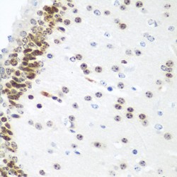Ubiquitin-Conjugating Enzyme E2 U (UBE2U) Antibody