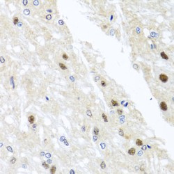 YTH Domain Family Protein 3 (YTHDF3) Antibody