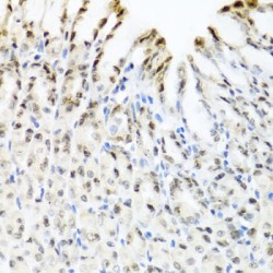 YTH Domain Family Protein 3 (YTHDF3) Antibody