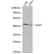 Western blot analysis of extracts of various cell lines using AGXT Antibody (1/1000 dilution).