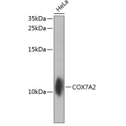Western blot analysis of extracts of HeLa cells using COX7A2 Antibody (1/1000 dilution).
