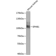 Western blot analysis of extracts of mouse kidney using EPHB1 Antibody (1/1000 dilution).