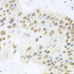 Zinc Finger And BTB Domain-Containing Protein 17 (ZBTB17) Antibody