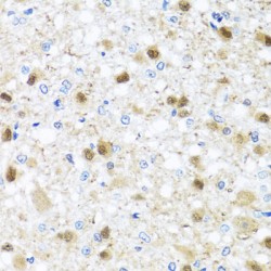 Zinc Finger And BTB Domain-Containing Protein 17 (ZBTB17) Antibody