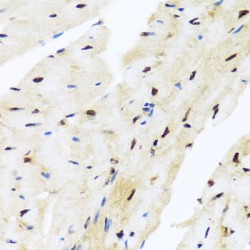 Zinc Finger And BTB Domain-Containing Protein 17 (ZBTB17) Antibody