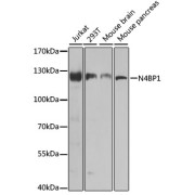 Western blot analysis of extracts of various cell lines using N4BP1 Antibody (1/1000 dilution).