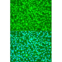 NEDD4 Binding Protein 1 (N4BP1) Antibody