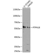 Western blot analysis of extracts of various cell lines using PTPN18 Antibody (1/1000 dilution).