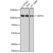 Western blot analysis of extracts of various cell lines using VEPH1 Antibody (1/1000 dilution).